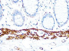 Anti-Calponin Antibody, clone 1E8M8, Rabbit Monoclonal