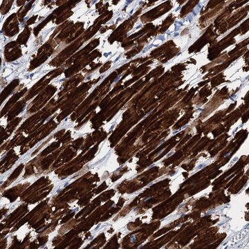 Anti-ELAC1 antibody produced in rabbit Prestige Antibodies&#174; Powered by Atlas Antibodies, affinity isolated antibody, buffered aqueous glycerol solution