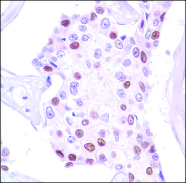 Anti-Progesterone Receptor antibody, Rabbit monoclonal recombinant, expressed in proprietary host, clone SP42, tissue culture supernatant