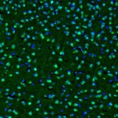 Anti-OGFOD1 antibody produced in rabbit Prestige Antibodies&#174; Powered by Atlas Antibodies, affinity isolated antibody, buffered aqueous glycerol solution