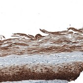 Monoclonal Anti-KRT5 antibody produced in mouse Prestige Antibodies&#174; Powered by Atlas Antibodies, clone CL9297, purified immunoglobulin, buffered aqueous glycerol solution