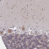 Anti-DAB1 antibody produced in rabbit Prestige Antibodies&#174; Powered by Atlas Antibodies, affinity isolated antibody, buffered aqueous glycerol solution