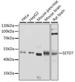 Anti-SETD7 antibody produced in rabbit