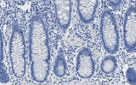 Anti-TOMM20 Antibody, clone 2F8.1 ZooMAb&#174; Mouse Monoclonal recombinant, expressed in HEK 293 cells