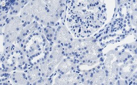 Anti-SLC5A2 Antibody, clone 2I4 ZooMAb&#174; Rabbit Monoclonal recombinant, expressed in HEK 293 cells