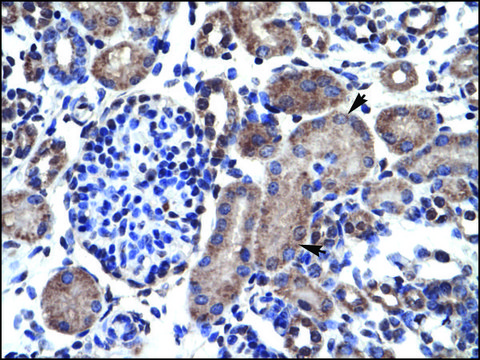 Anti-BCL2 antibody produced in rabbit affinity isolated antibody