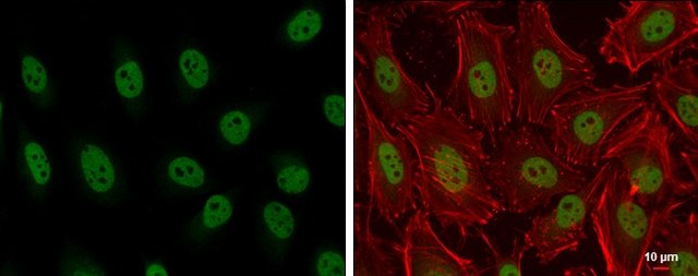 Anti-ARID2 antibody produced in rabbit affinity isolated antibody