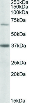 Anti-CPT2 antibody produced in goat affinity isolated antibody, buffered aqueous solution