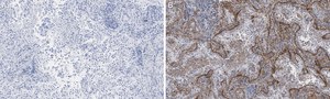 Anti-Integrin &#945;V&#946;5 Antibody, clone EM09902 , ZooMAb&#174; Rabbit Monoclonal recombinant, expressed in HEK 293 cells