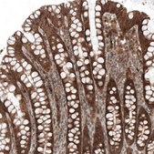 Monoclonal Anti-BAX antibody produced in mouse Prestige Antibodies&#174; Powered by Atlas Antibodies, clone CL7919, purified immunoglobulin, buffered aqueous glycerol solution
