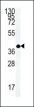 ANTI-TM111 (N-TERMINAL) antibody produced in rabbit affinity isolated antibody, buffered aqueous solution