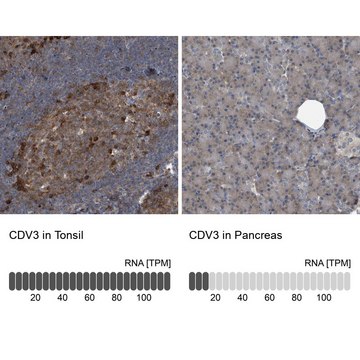 Anti-CDV3 antibody produced in rabbit Prestige Antibodies&#174; Powered by Atlas Antibodies, affinity isolated antibody, buffered aqueous glycerol solution, ab3