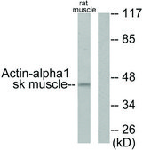 Anti-ACTIN-&#945;-1 antibody produced in rabbit affinity isolated antibody