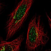 Anti-TYMP antibody produced in rabbit Prestige Antibodies&#174; Powered by Atlas Antibodies, affinity isolated antibody