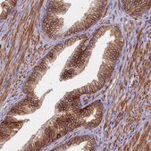 Anti-TRPM4 antibody produced in rabbit Prestige Antibodies&#174; Powered by Atlas Antibodies, affinity isolated antibody, buffered aqueous glycerol solution