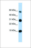 Anti-FABP4 antibody produced in rabbit affinity isolated antibody