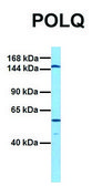 Anti-POLQ (C-terminal) antibody produced in rabbit affinity isolated antibody