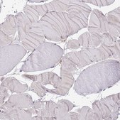 Anti-LPIN2 antibody produced in rabbit Prestige Antibodies&#174; Powered by Atlas Antibodies, affinity isolated antibody, buffered aqueous glycerol solution