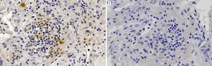 Anti-Ganglioside GD2 Antibody, clone 14G2a ZooMAb&#174; Mouse Monoclonal recombinant, expressed in HEK 293 cells