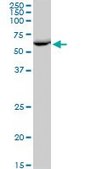 Anti-EPHX2 antibody produced in mouse IgG fraction of antiserum, buffered aqueous solution