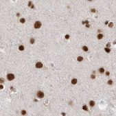 Anti-PPP1R8 antibody produced in rabbit Prestige Antibodies&#174; Powered by Atlas Antibodies, affinity isolated antibody, buffered aqueous glycerol solution, Ab2