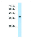 Anti-LOR IgG fraction of antiserum