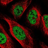 Anti-PPP4R2 antibody produced in rabbit Prestige Antibodies&#174; Powered by Atlas Antibodies, affinity isolated antibody, buffered aqueous glycerol solution