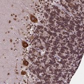 Anti-MTDH antibody produced in rabbit Prestige Antibodies&#174; Powered by Atlas Antibodies, affinity isolated antibody, buffered aqueous glycerol solution