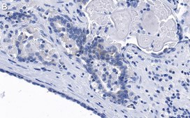 Anti-phospho-eIF-2&#945;-Ser51 Antibody, clone 4N22 ZooMAb&#174; Rabbit Monoclonal recombinant, expressed in HEK 293 cells