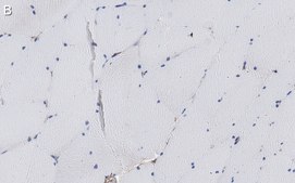 Anti-&#945;-Dystroglycan Antibody, clone VIA4-1 ZooMAb&#174; Mouse Monoclonal recombinant, expressed in HEK 293 cells