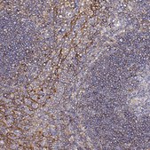 Anti-CD47 antibody produced in rabbit Prestige Antibodies&#174; Powered by Atlas Antibodies, affinity isolated antibody, buffered aqueous glycerol solution