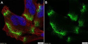 Anti-MCT1/SLC16A1 Antibody, clone 2B21 ZooMAb&#174; Rabbit Monoclonal recombinant, expressed in HEK 293 cells