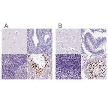 Anti-SPESP1 antibody produced in rabbit Prestige Antibodies&#174; Powered by Atlas Antibodies, affinity isolated antibody, buffered aqueous glycerol solution