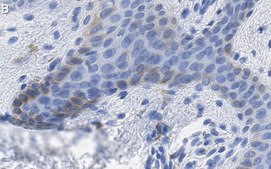 Anti-MITF Antibody, clone 1E2 ZooMAb&#174; Rabbit Monoclonal recombinant, expressed in HEK 293 cells