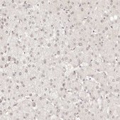 Anti-MEP1A antibody produced in rabbit Prestige Antibodies&#174; Powered by Atlas Antibodies, affinity isolated antibody, buffered aqueous glycerol solution