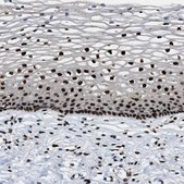 Anti-NUMA1 antibody produced in rabbit Prestige Antibodies&#174; Powered by Atlas Antibodies, affinity isolated antibody, buffered aqueous glycerol solution, Ab2