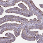 Anti-IFIT1 antibody produced in rabbit Prestige Antibodies&#174; Powered by Atlas Antibodies, affinity isolated antibody, buffered aqueous glycerol solution