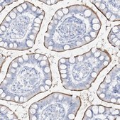 Anti-SLC26A3 antibody produced in rabbit Prestige Antibodies&#174; Powered by Atlas Antibodies, affinity isolated antibody, buffered aqueous glycerol solution