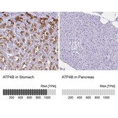 Anti-ATP4B antibody produced in rabbit Prestige Antibodies&#174; Powered by Atlas Antibodies, affinity isolated antibody, buffered aqueous glycerol solution