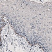 Monoclonal Anti-LAMA3 antibody produced in mouse Prestige Antibodies&#174; Powered by Atlas Antibodies, clone CL3112, purified immunoglobulin, buffered aqueous glycerol solution
