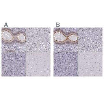 Anti-ZNF185 antibody produced in rabbit Prestige Antibodies® Powered by Atlas Antibodies, affinity isolated antibody, buffered aqueous glycerol solution
