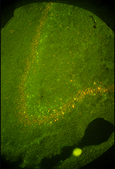Anti-Ferritin, Human antibody produced in rabbit whole antiserum, liquid