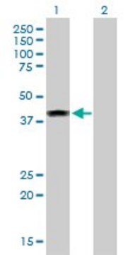 Anti-ELAC1 antibody produced in rabbit purified immunoglobulin, buffered aqueous solution