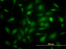 Monoclonal Anti-TYMS antibody produced in mouse clone 3A1, purified immunoglobulin, buffered aqueous solution