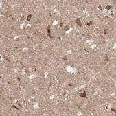 Anti-OPTN antibody produced in rabbit Ab1, Prestige Antibodies&#174; Powered by Atlas Antibodies, affinity isolated antibody, buffered aqueous glycerol solution