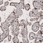Monoclonal Anti-SMCHD1 antibody produced in mouse Prestige Antibodies&#174; Powered by Atlas Antibodies, clone CL4270, purified immunoglobulin
