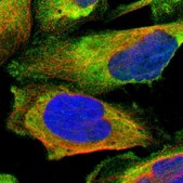 Anti-LRRFIP1 antibody produced in rabbit Prestige Antibodies&#174; Powered by Atlas Antibodies, affinity isolated antibody, buffered aqueous glycerol solution