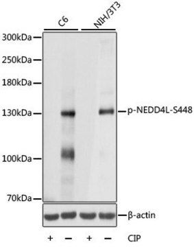 Anti-Phospho-NEDD4L-S448 antibody produced in rabbit