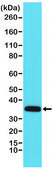 Anti-Calponin-1 antibody, Rabbit monoclonal recombinant, expressed in HEK 293 cells, clone RM262, purified immunoglobulin