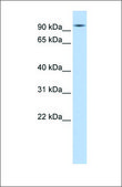 Anti-HSP90AA1 (ab2) antibody produced in rabbit affinity isolated antibody